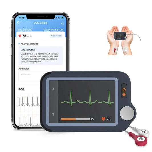 Appareil ECG Portable CheckMe Plus avec Bluetooth et Analyse en Temps Réel